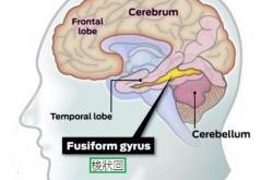 脸盲证是什么引起的