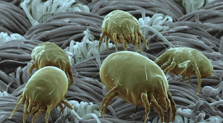 女孩睡觉半夜憋醒以为是中邪 医生回复:羽绒被螨虫作祟