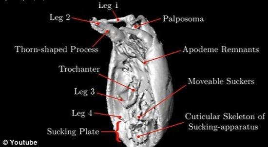 女孩睡觉半夜憋醒以为是中邪 医生回复:羽绒被螨虫作祟